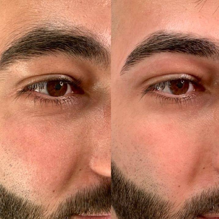 Sobrancelha masculina alinhada em Viamão - RS